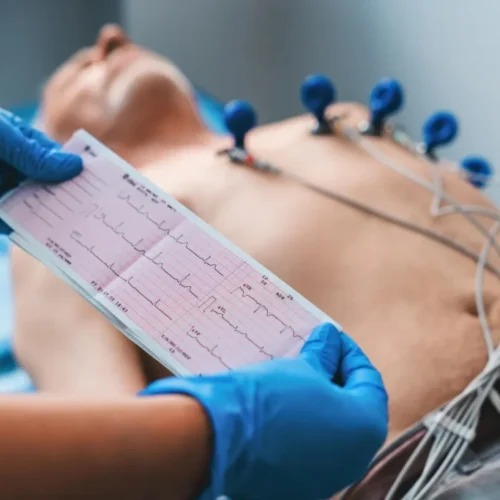 ekg constanta
