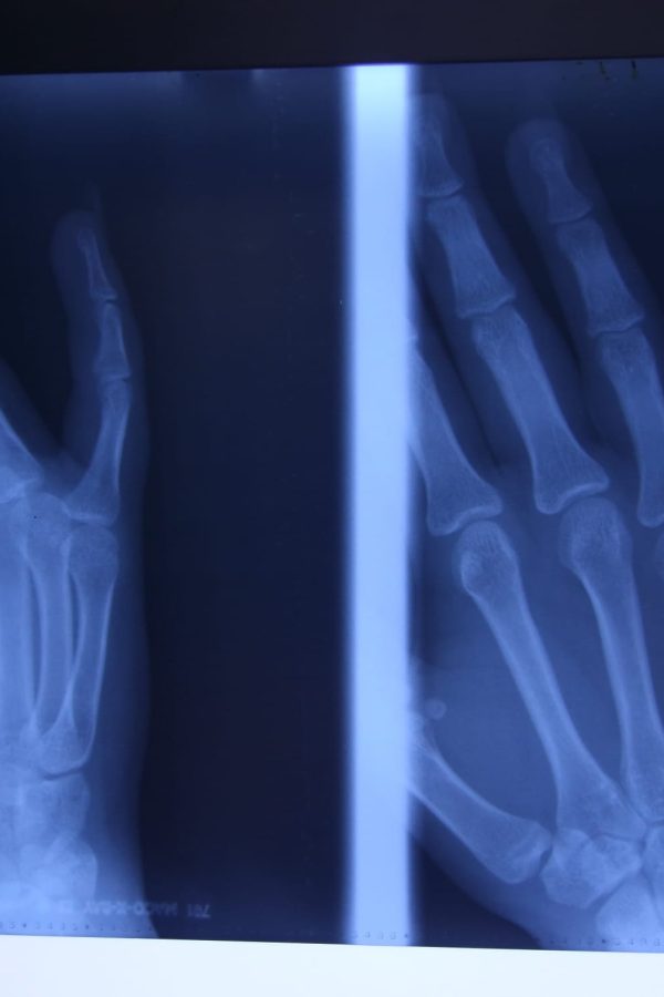 RADIOGRAFIE PACIENT 1
