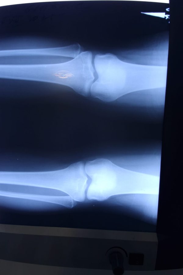 RADIOGRAFIE PACIENT